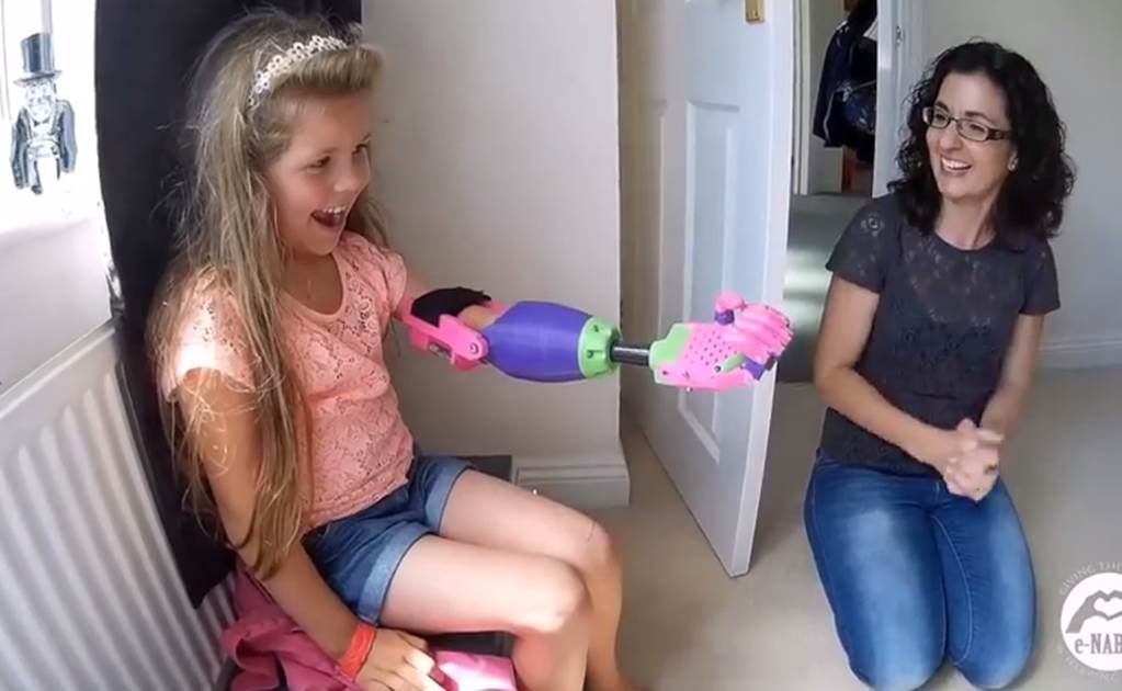 La reacción de una niña con su nuevo brazo impreso en 3D