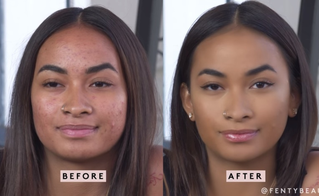 Rihanna lanza tutorial de maquillaje para chicas con acné