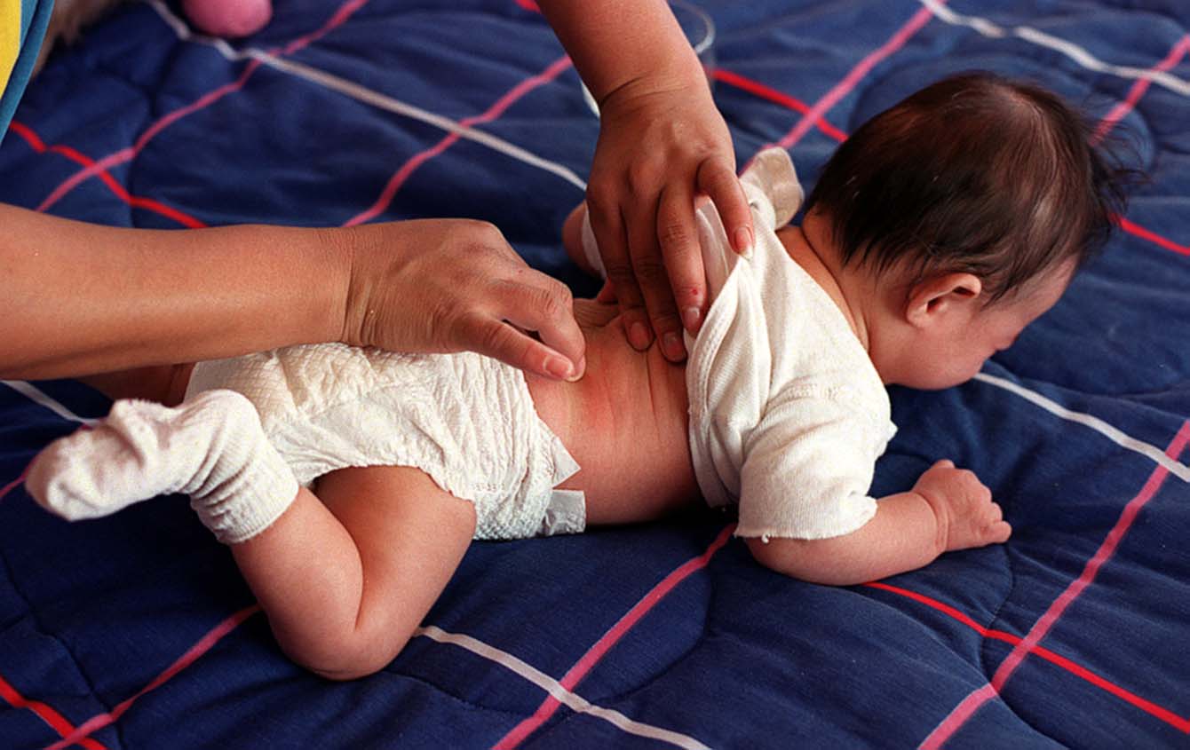 Cuando curaban a los niños con remedios caseros