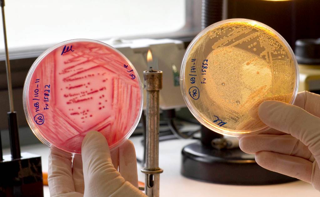 Anticuerpos "armados" con antibióticos vencen bacterias resistentes