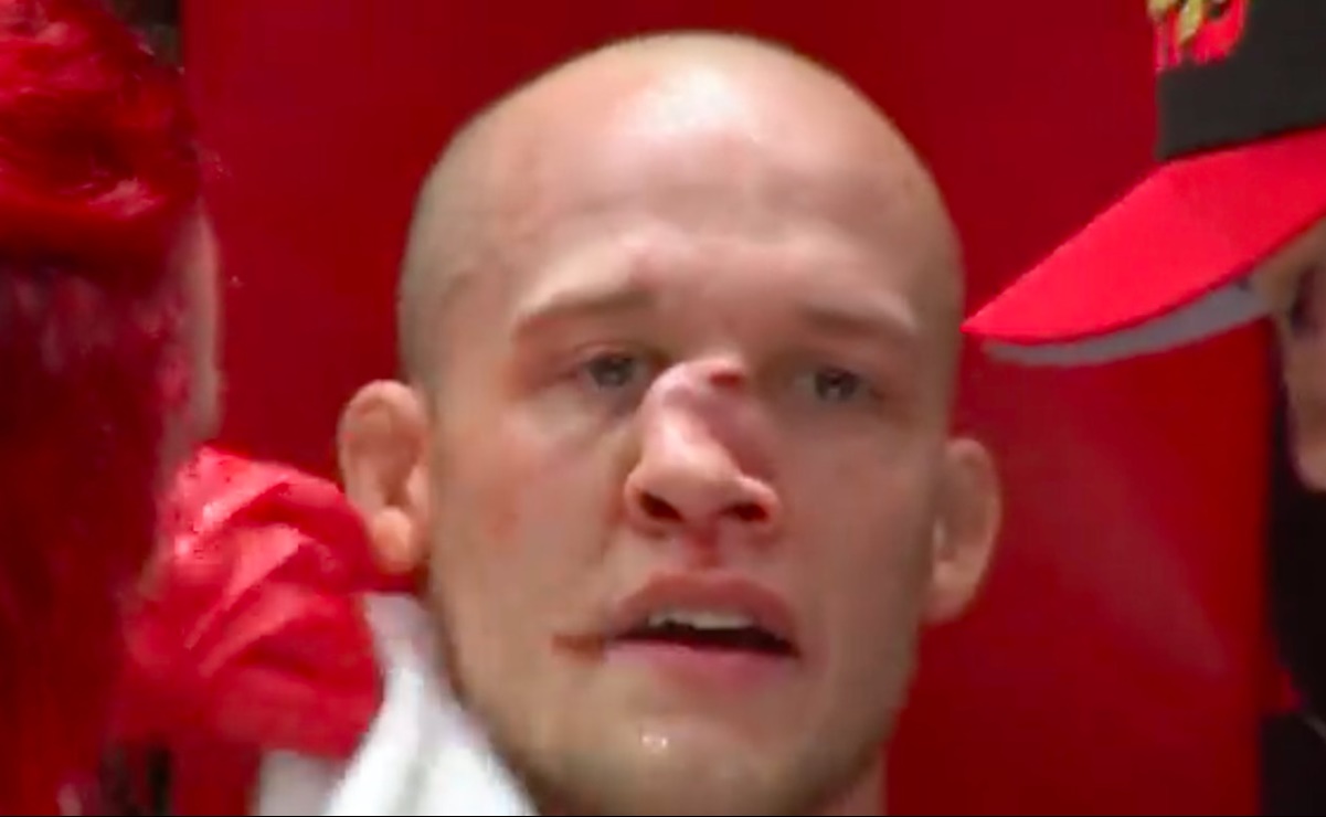 VIDEO. Pelador de MMA recibe brutal golpe que le desfigura la nariz