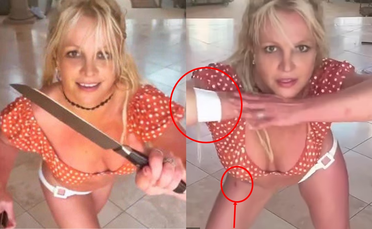 Britney Spears aparece vendada y con heridas, tras grabar video con cuchillos