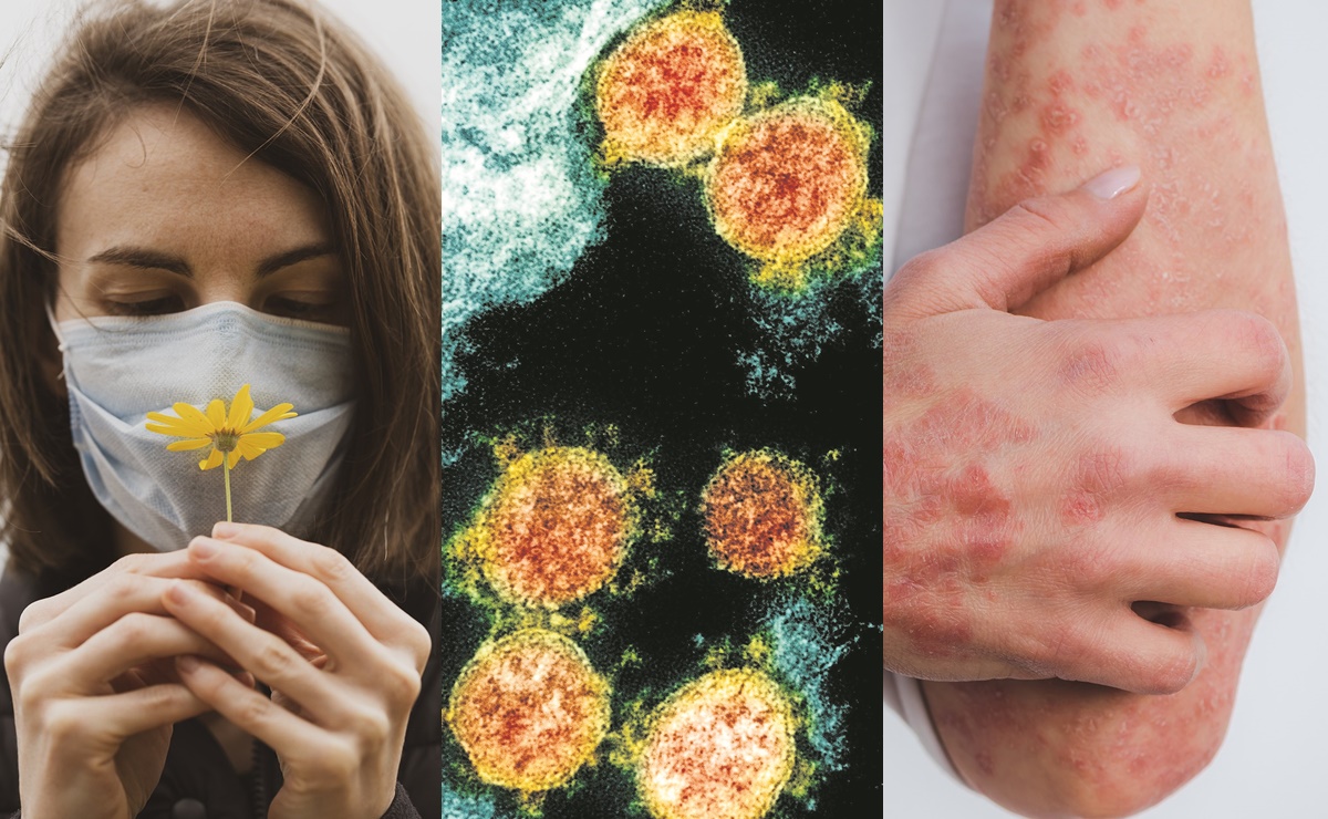 De fatiga a erupciones en la piel: las secuelas del Covid-19, según los CDC  