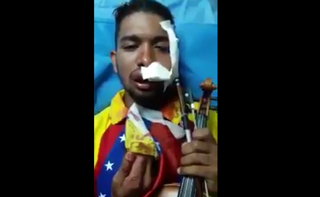 Video. Violinista de protestas contra Maduro es gravemente herido en marcha