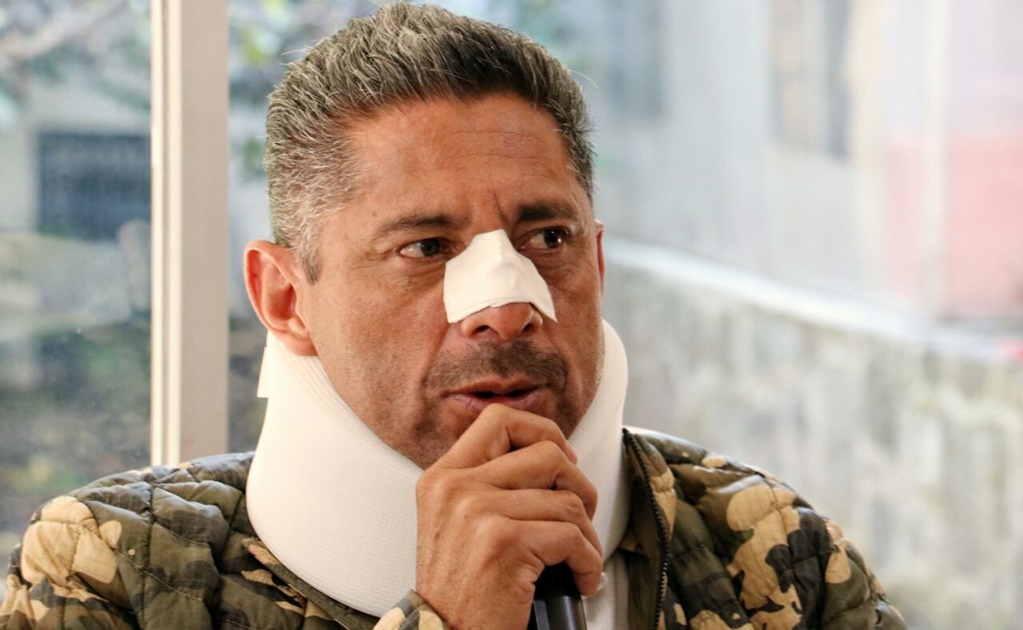 Alcalde sufrió fracturas por evitar linchamiento en Edomex