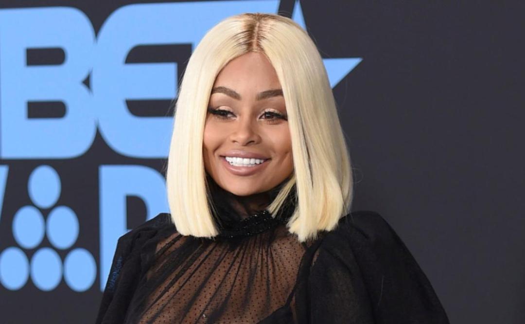 Blac Chyna muestra su nueva cara en un antes y después tras retirarse los fillers