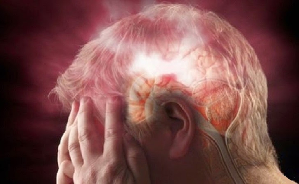 Una de cada tres personas podría sufrir un "mini derrame" cerebral sin saberlo