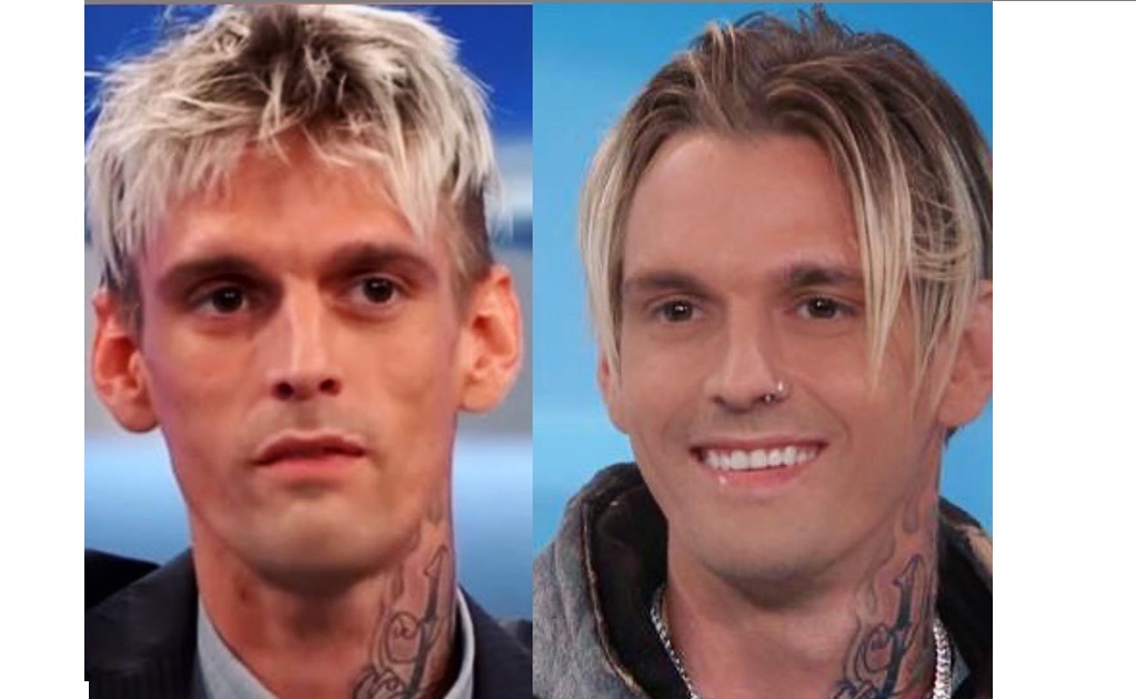 Aaron Carter padece de esquizofrenia, bipolaridad, depresión y ansiedad 