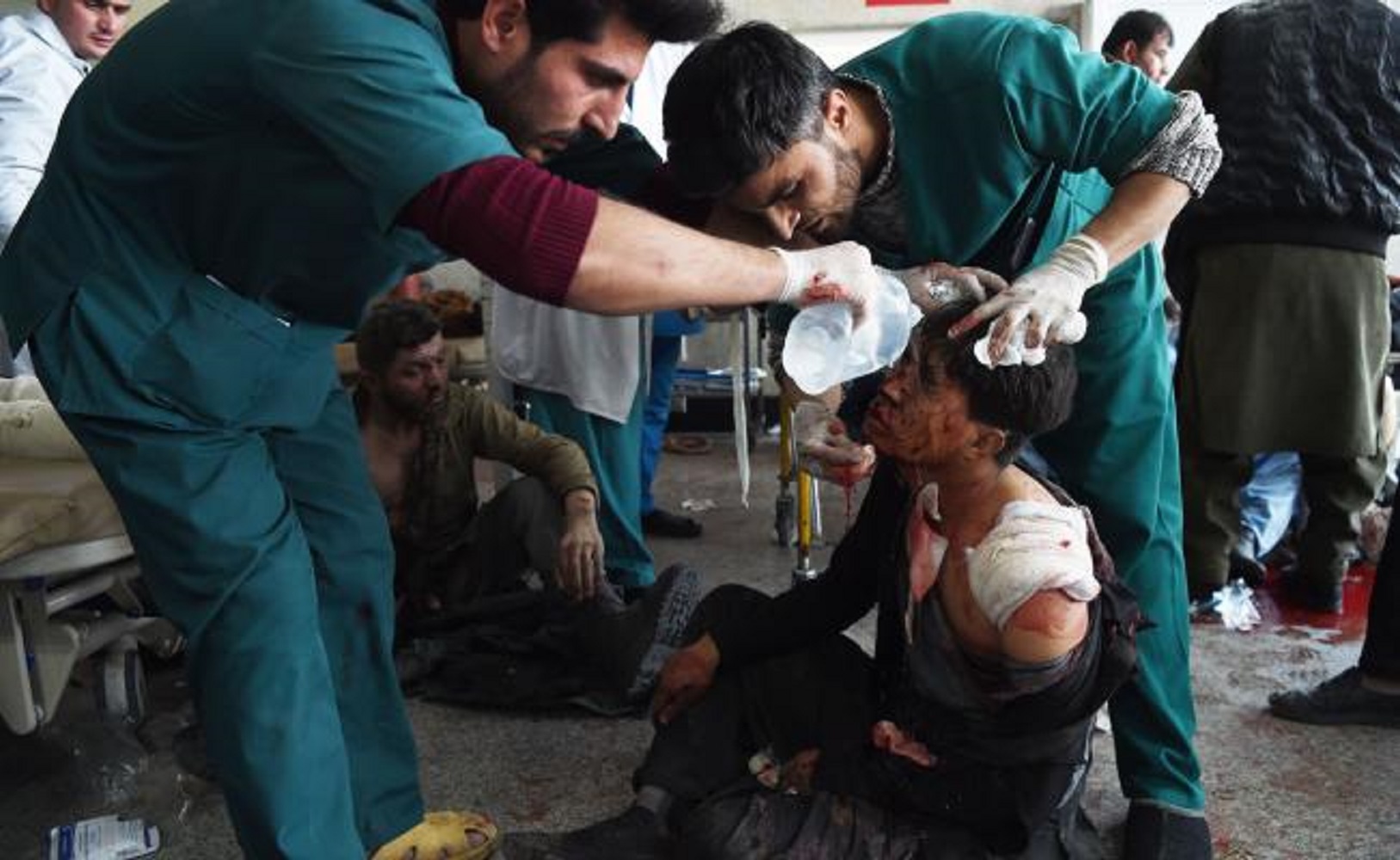 Atentado con ambulancia bomba en Kabul deja casi 100 muertos