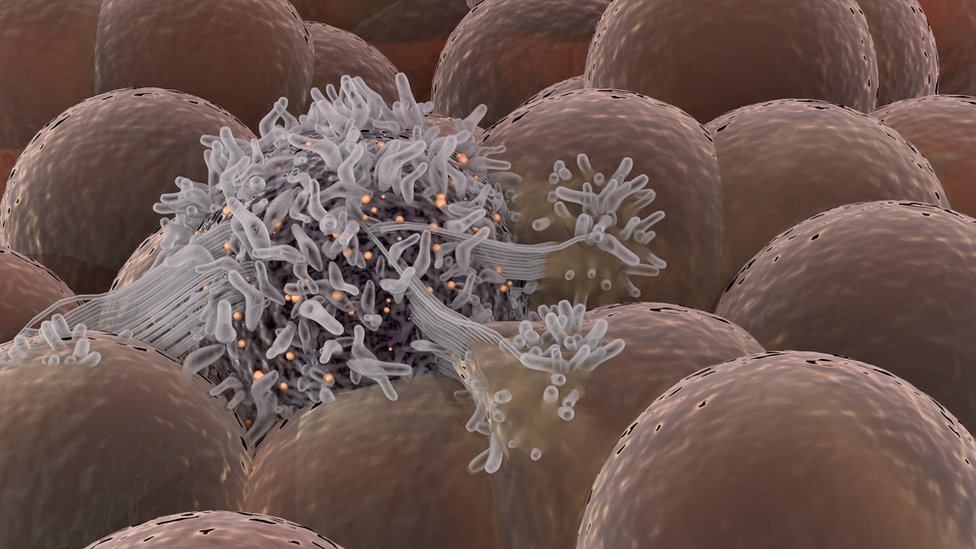 Cómo unas células "sordas" y "manipuladoras" originan el cáncer