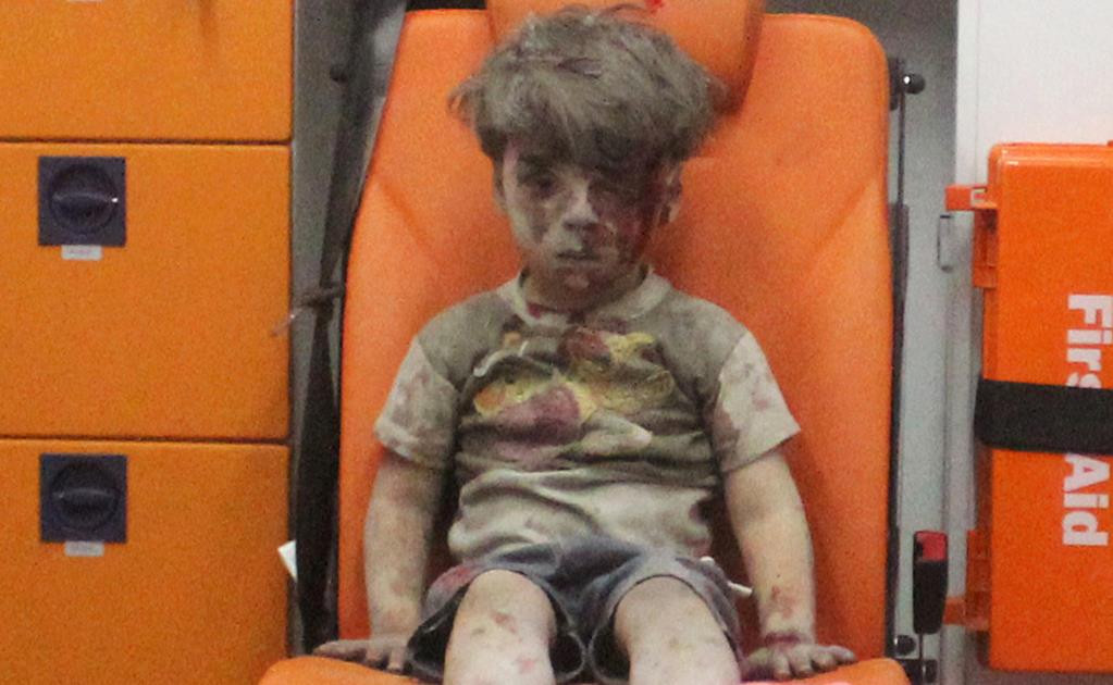 Niño pide a Obama que le ayude a llevar a menor sirio herido a su casa