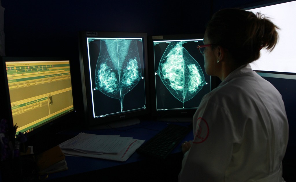 Tecnología 3D para reconstruir senos en mujeres con cáncer 