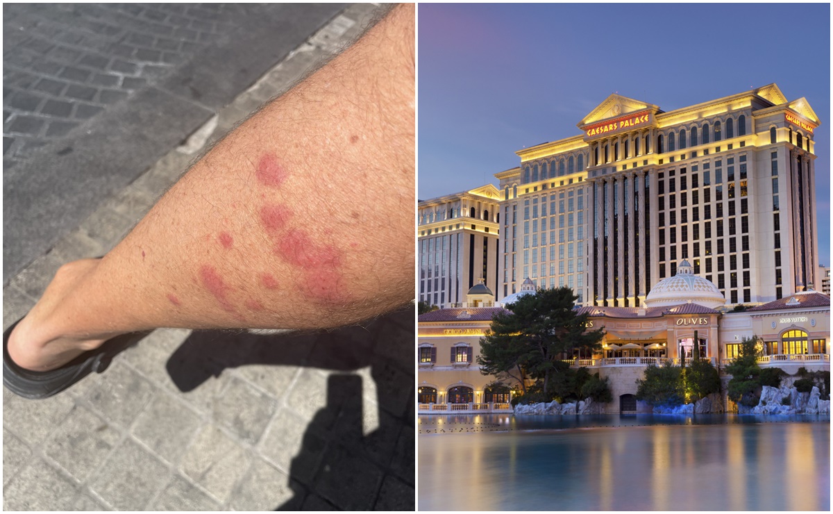 Huéspedes acusan que estos lujosos hoteles en Las Vegas tienen chinches