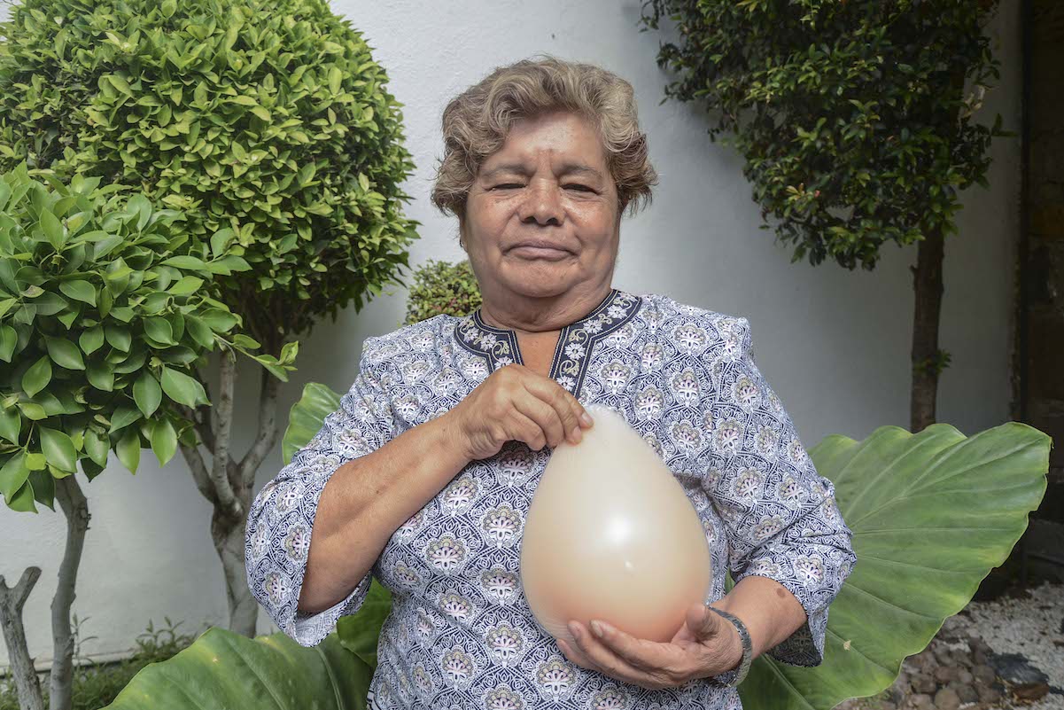 “Me veo en el espejo y me veo normal, un pecho no es nada”