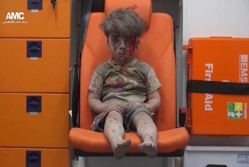 Imagen de niño herido en Alepo se vuelve viral