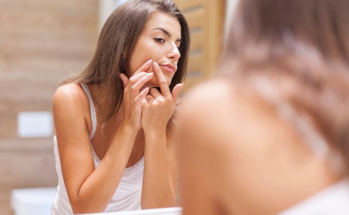 Aprende a eliminar los granitos de tu rostro sin dejar cicatrices