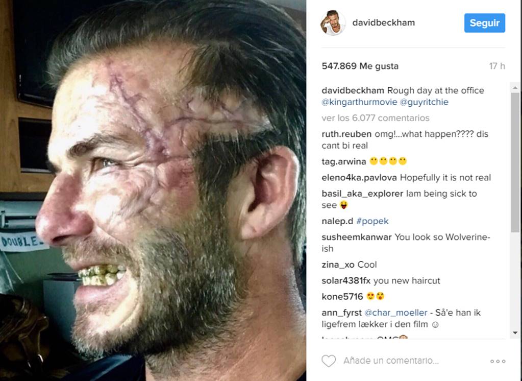Beckham impacta Instagram con cicatriz