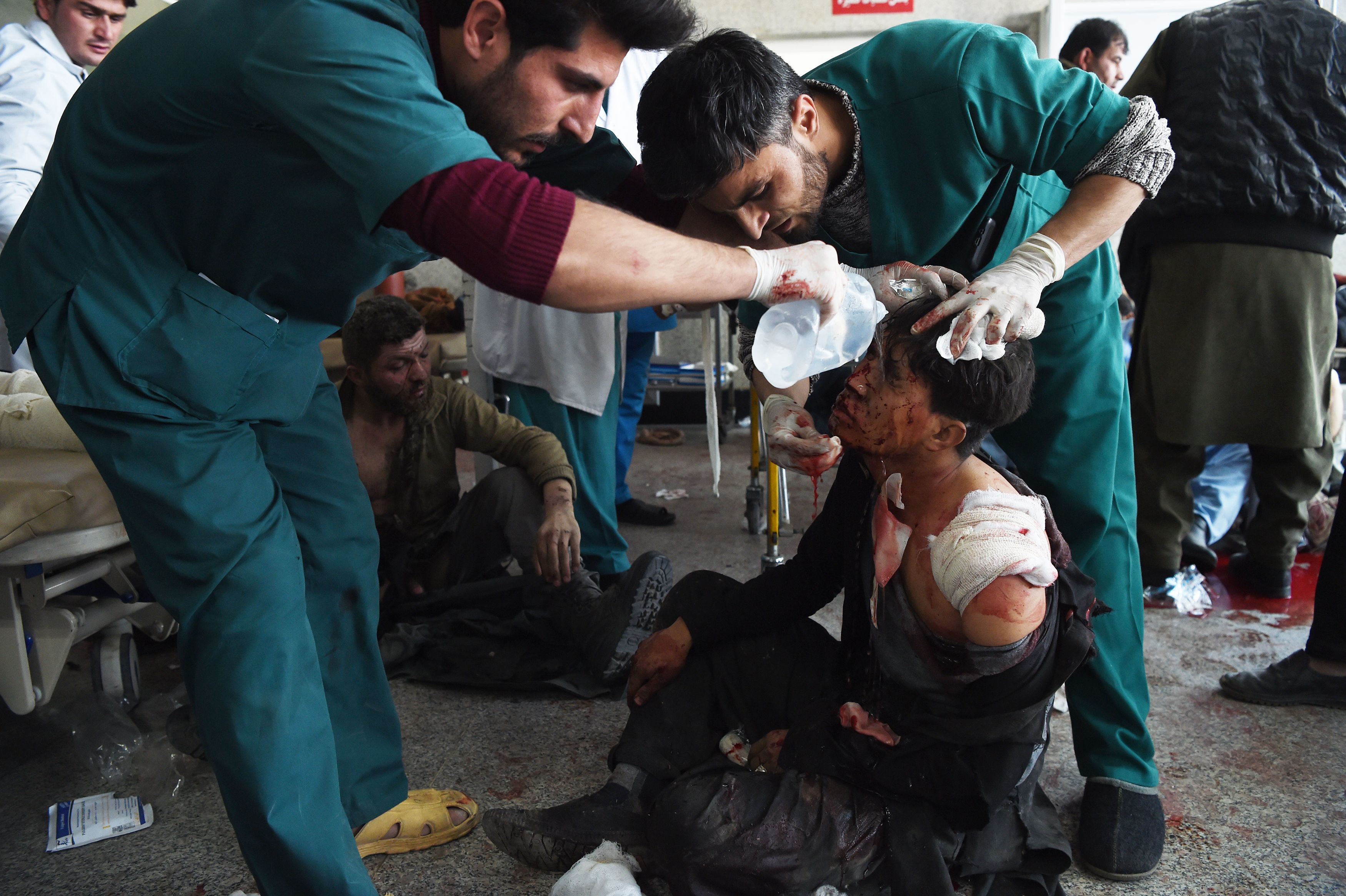 "Es una masacre"; atentado con ambulancia bomba en Kabul deja casi 100 muertos