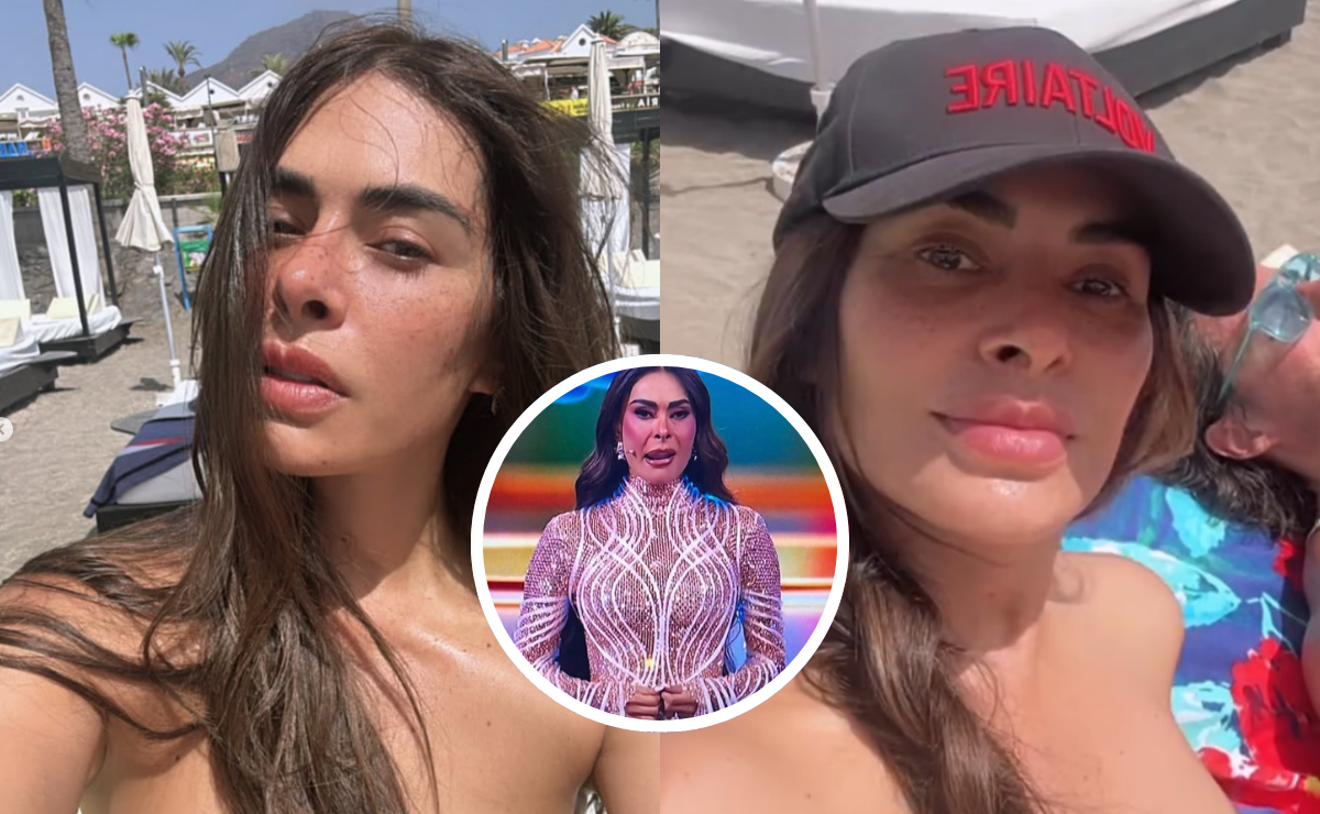 "¿Qué le pasó en el rostro?" Galilea Montijo vuelve a generar preocupación entre sus fans. Foto: Instagram / X