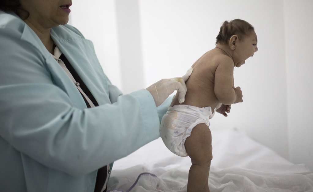 Detectan caso de microcefalia en Venezuela