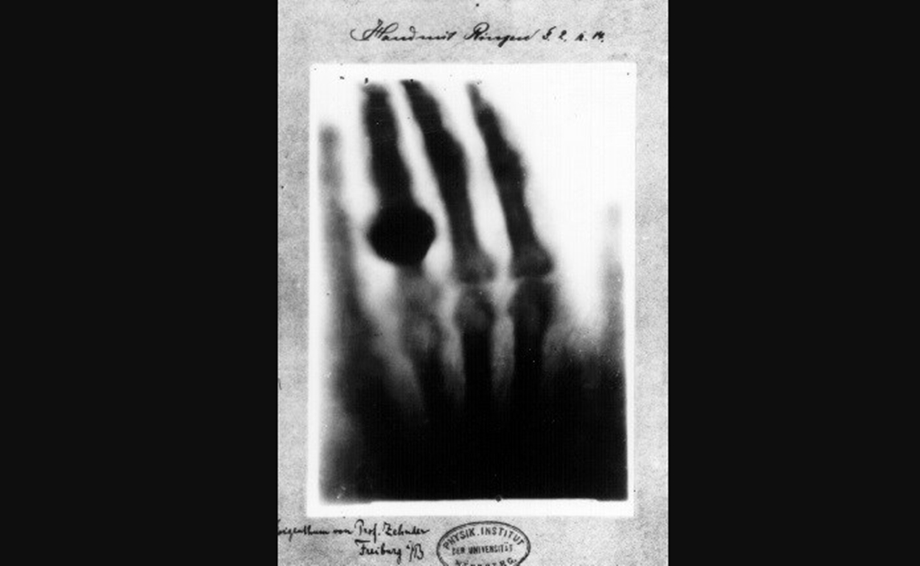 El descubrimiento de los rayos X cumple 122 años