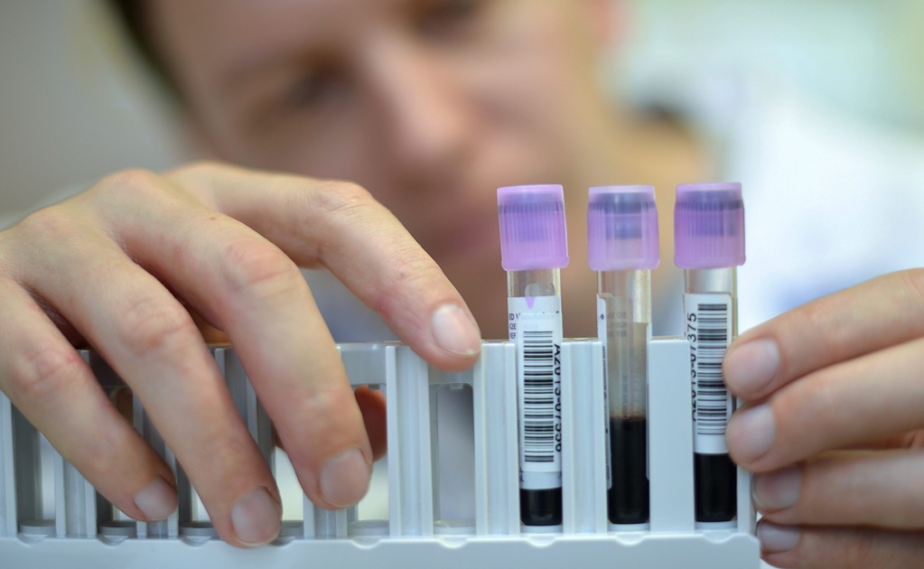 Banco de Sangre de Cordón Umbilical cuenta con más de mil 700 unidades genéticas