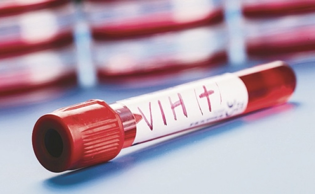 En riesgo, 162 mil pacientes de VIH por cambio de medicamento: Navarro Quintero