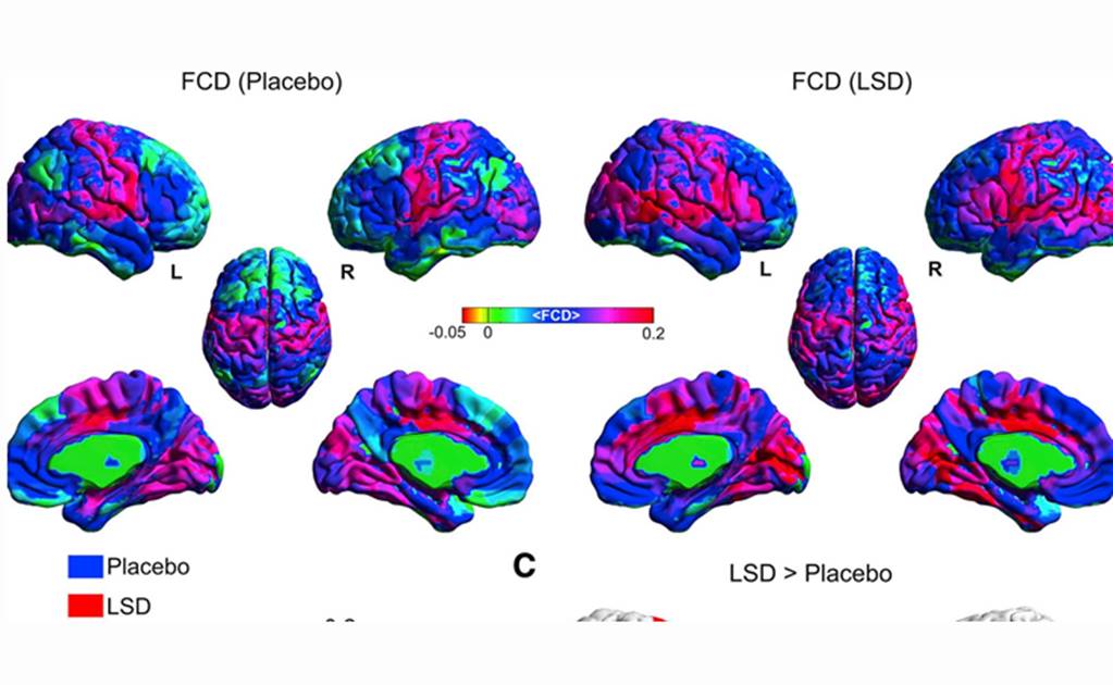 Los efectos del LSD en el cerebro