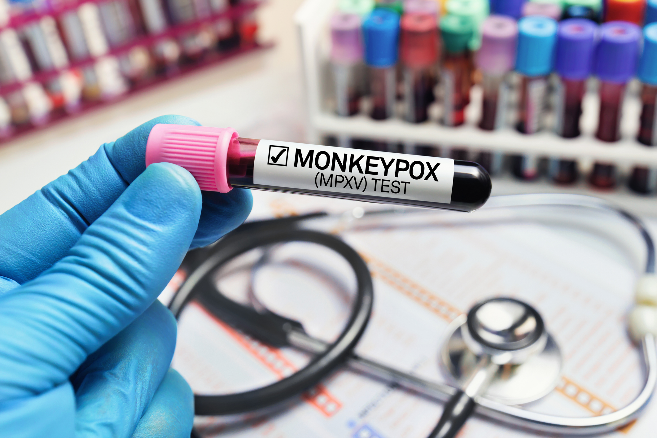 OMS alerta sobre nueva cepa mortal de mpox, viruela del mono