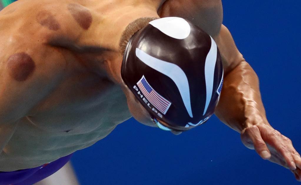 Michael Phelps y los círculos morados en la espalda