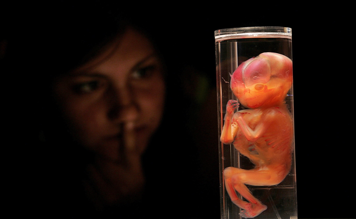 Exploran cómo se pliega el cerebro del feto a medida que se desarrolla