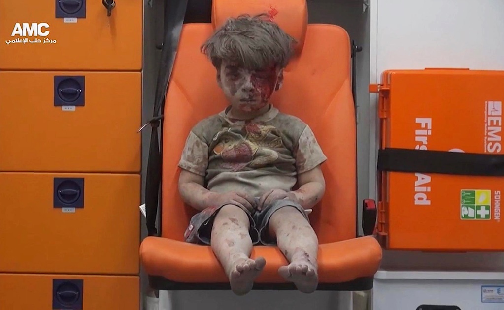 Imagen de niño herido en Aleppo se vuelve viral 