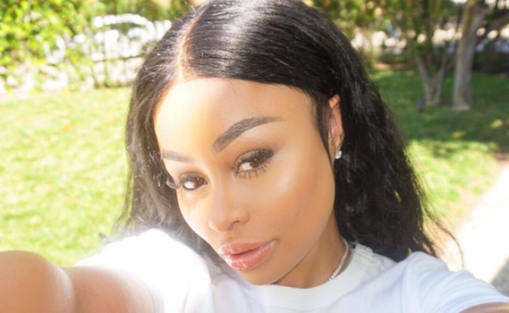 Blac Chyna, ex de Rob Kardashian, sufre accidente de tránsito