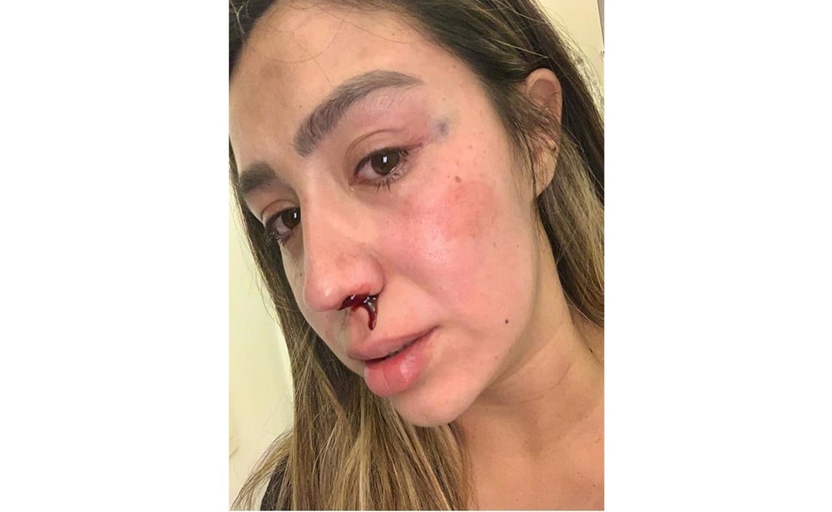 Instagramer denuncia a agresor: “33 días después del parto recibí patadas”