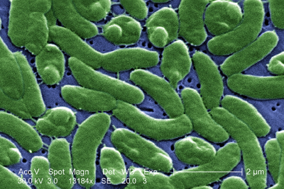 Bacteria mortal deja 3 muertos en EU. ¿Cuáles son sus síntomas?