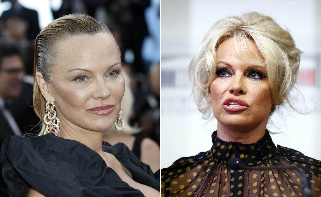 ¡¿Qué le pasó al rostro de Pamela Anderson?!