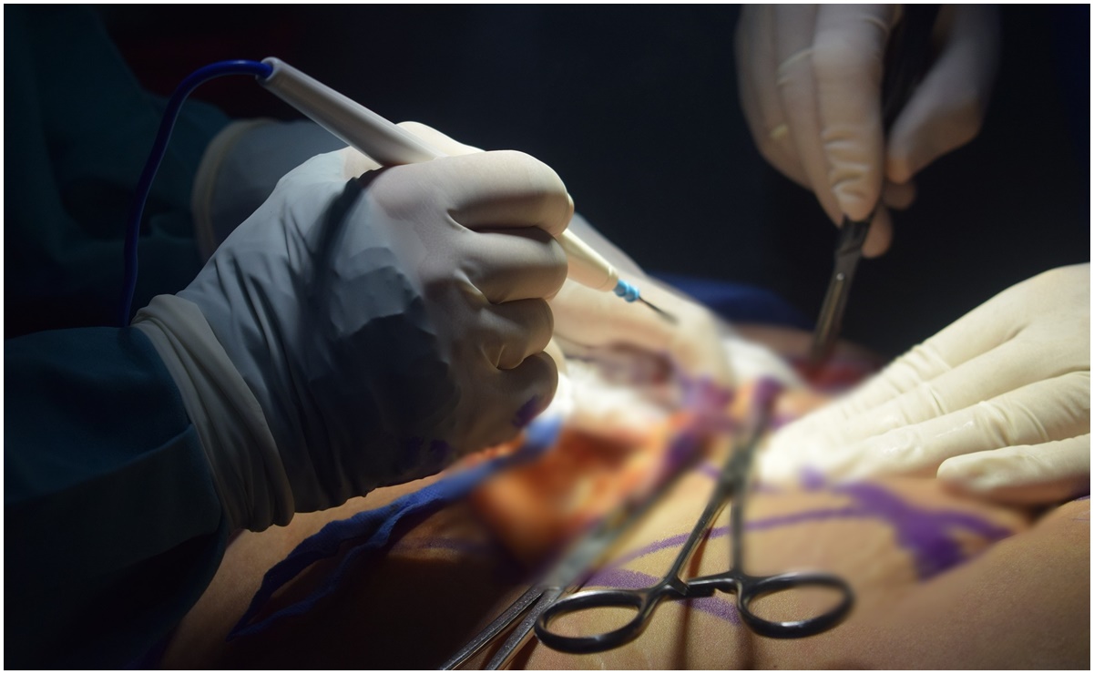 Cofepris debe entregar licencia para operar a clínica de cirugía plástica: INAI 