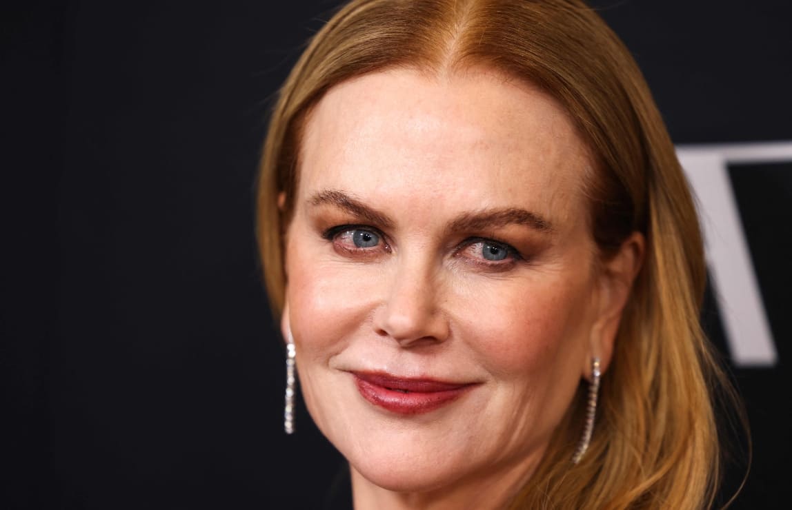 Nicole Kidman, blanco de críticas por la apariencia de su cara, ¿irreconocible?