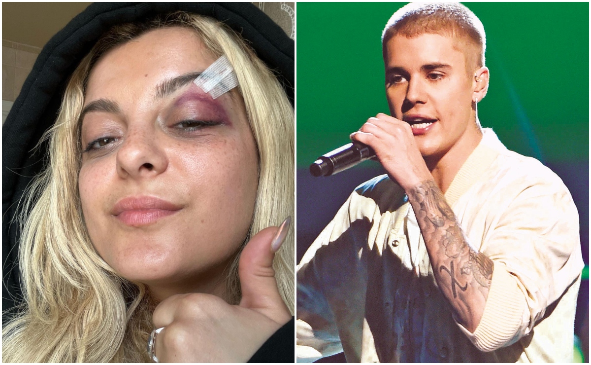 Bebe Rexha y más celebridades que fueron golpeadas por fans en el escenario