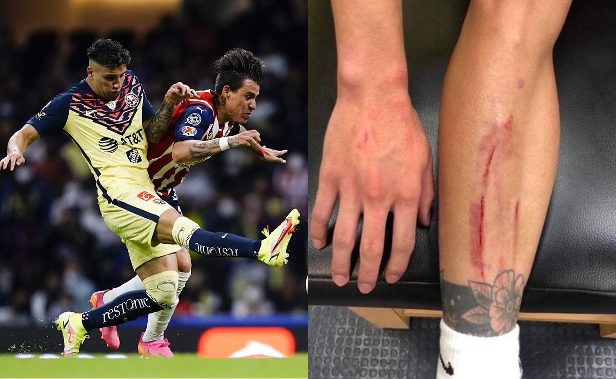 Jorge Sánchez muestra la herida que sufrió durante el Clásico Nacional