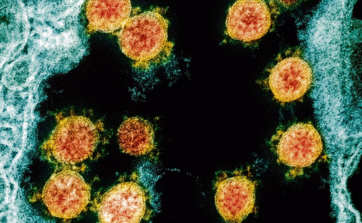 El coronavirus puede invadir y duplicarse en el cerebro: estudio