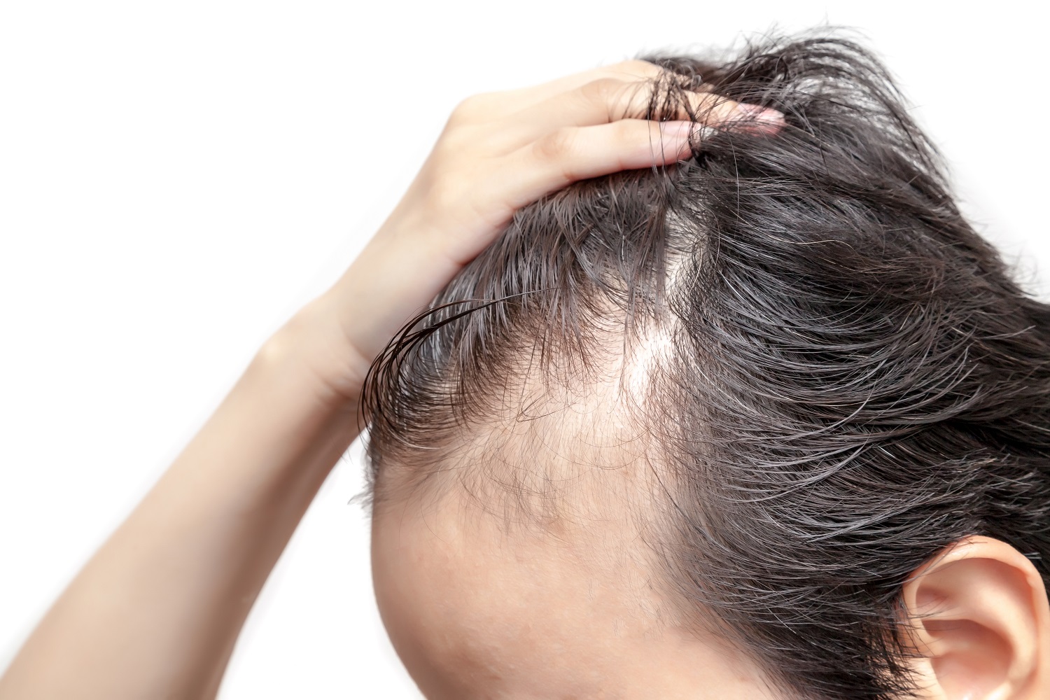 Cómo frenar la alopecia con remedios naturales, relajación baños calientes | Salud | La Revista | El Universo