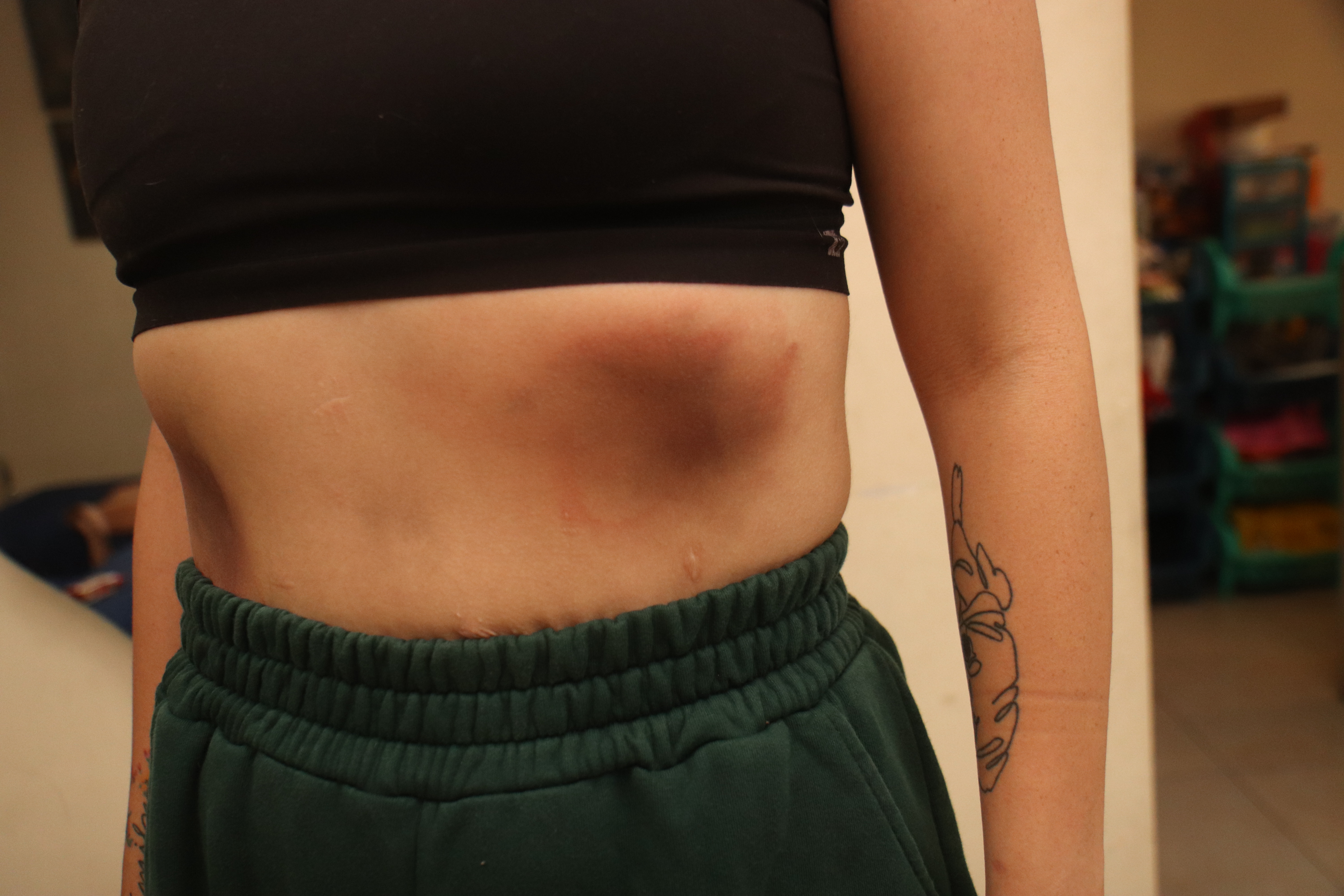 Una costilla fracturada y hasta un diente flojo tiene la mujer que fue  agredida en Sauces | Seguridad | Noticias | El Universo