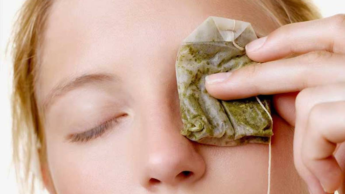 vertical aprender Brote 5 remedios naturales para quitar las ojeras | Salud | La Revista | El  Universo
