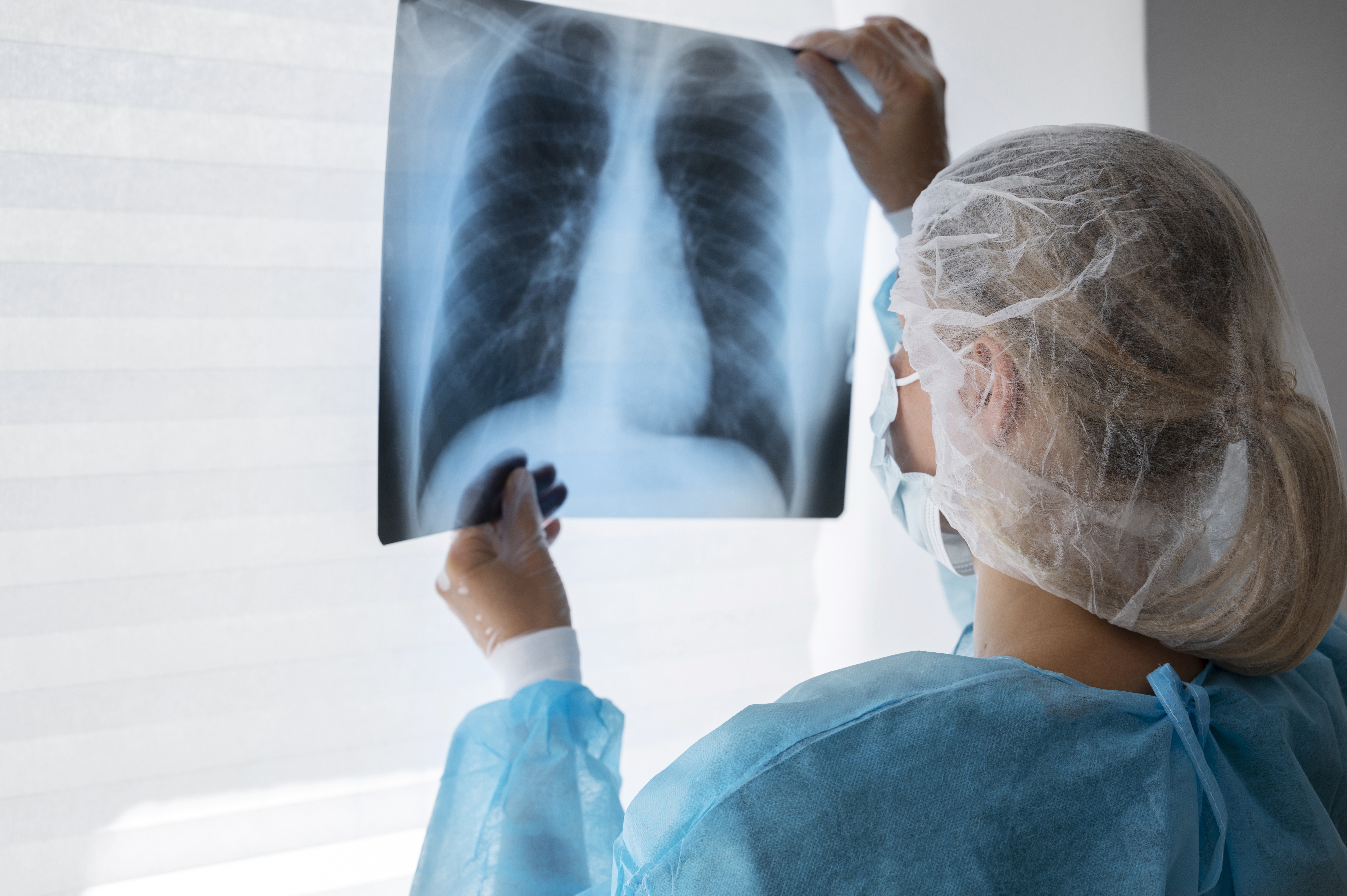 Quase 20% dos pacientes com câncer de pulmão continuam fumando