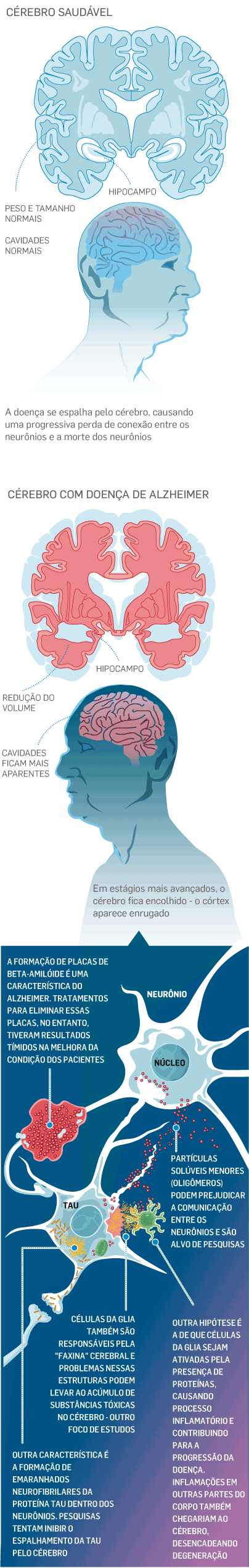 Demência: risco cai com hábitos como jogar xadrez e fazer palavra