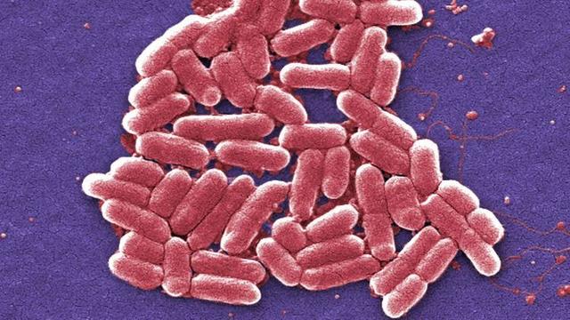 Fast Food Chain May Be Linked to Multistate E. Coli Outbreak