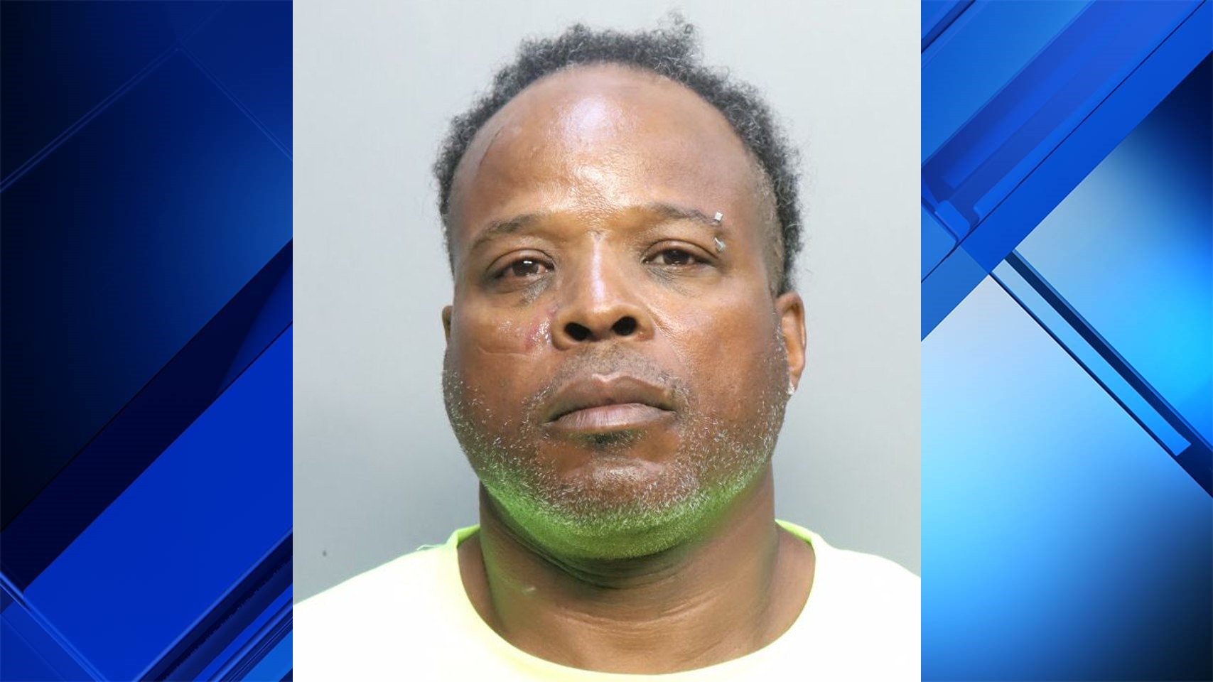 Miami-Dade man used bug spray, bleach, fists on pregnant girlfriends face, cops