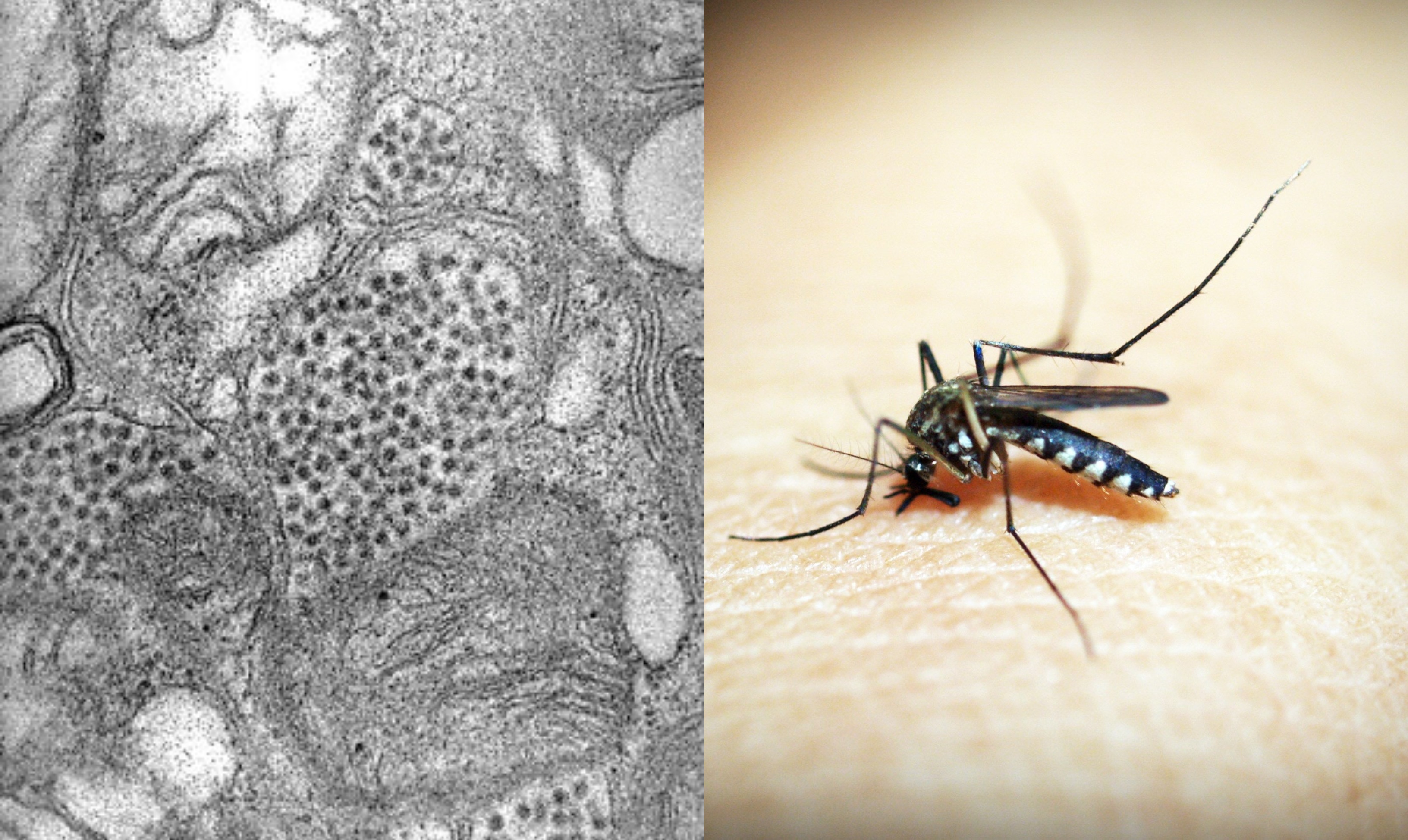 Mosquito-borne Eastern Equine Encephalitis virus: What to know