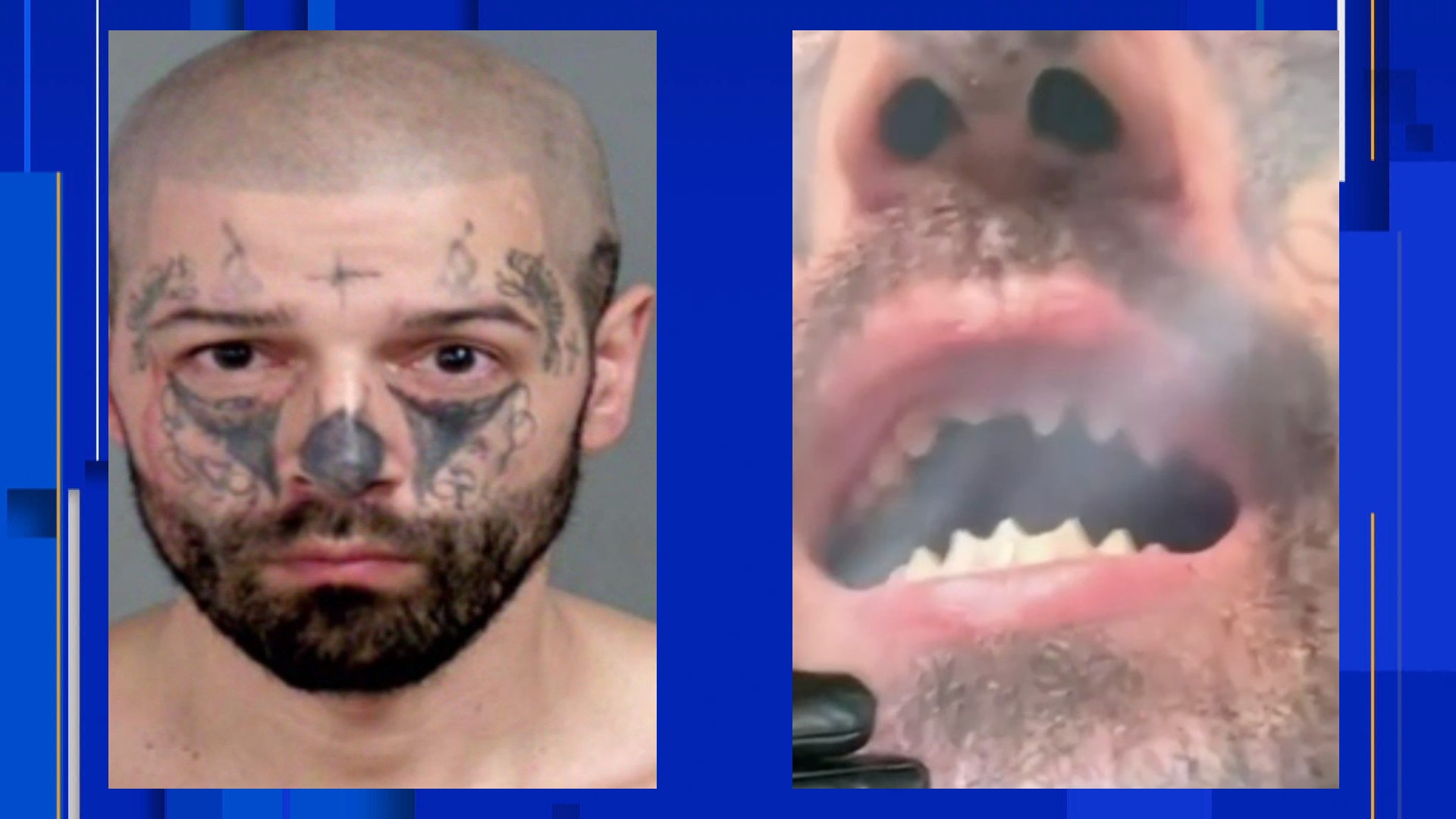 Michigan sex trafficker who filed teeth into points gets 20 more charges after 2nd victims story pic